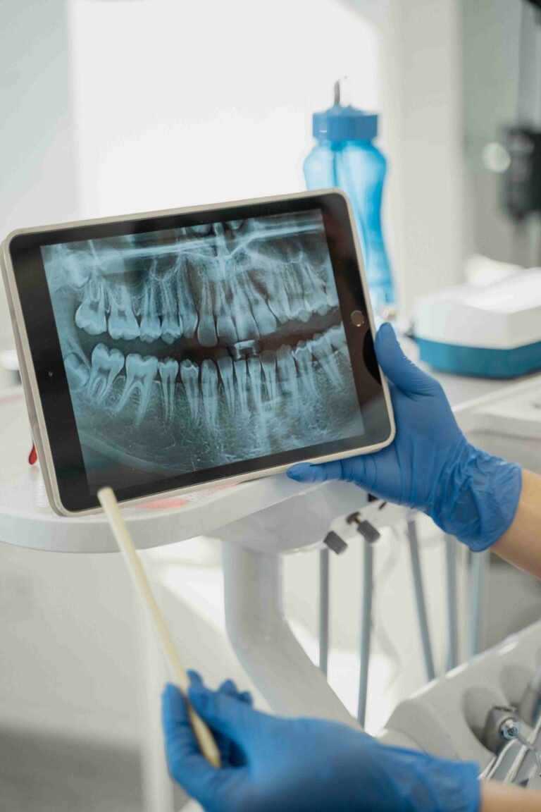 What Is Dental Equipment Finance?